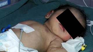 ದೇವಿ ದೇವಾಲಯದ ಮುಂದೆ ಅಮಾನವೀಯ ಘಟನೆ: ಮುಳ್ಳಿನ ಪೊದೆಯಲ್ಲಿ ಒದ್ದಾಡಿದ ಒಂದು ದಿನದ ಹೆಣ್ಣು ಮಗು