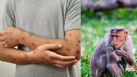 ಶಿವಮೊಗ್ಗದಲ್ಲಿ ಮತ್ತೆ ವಕ್ಕರಿಸಿದ ಮಂಗನ ಕಾಯಿಲೆ: ಕಾಡಿನಂಚಿನ ಜನರಲ್ಲಿ ಆತಂಕ