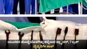 ಯುವಕನ ಹೊಟ್ಟೆಯೊಳಗಿತ್ತು ಕಬ್ಬಿಣದ ಸ್ಪ್ಯಾನರ್‌, 7 ಬ್ರಶ್; ವೈದ್ಯರಿಗೇ ಶಾಕ್