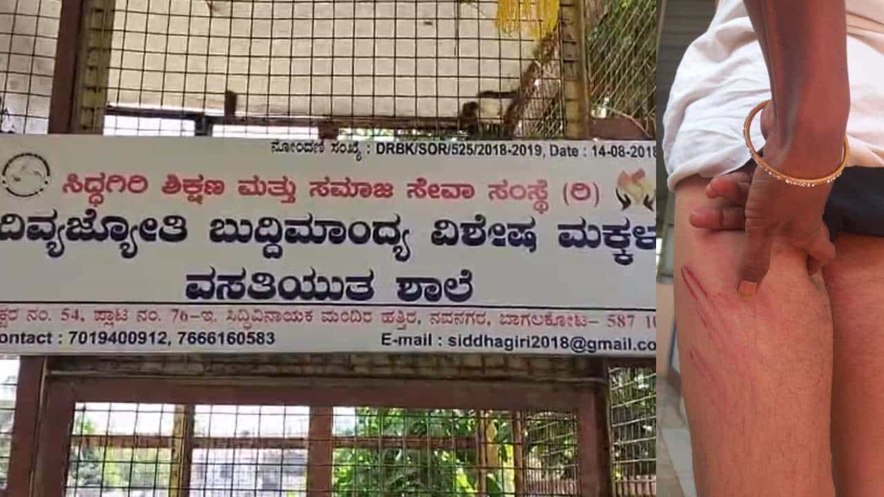 ಬುದ್ಧಿಮಾಂದ್ಯ ಬಾಲಕನ ಮೇಲೆ ಶಿಕ್ಷಕ ದಂಪತಿಯಿಂದ ಹಲ್ಲೆ: ಕಣ್ಣಿಗೆ ಖಾರದಪುಡಿ ಎರಚಿ ಹೇಯ ಕೃತ್ಯ ಬುದ್ಧಿಮಾಂದ್ಯ ಬಾಲಕನ ಮೇಲೆ ಶಿಕ್ಷಕ ದಂಪತಿಯಿಂದ ಹಲ್ಲೆ: ಕಣ್ಣಿಗೆ ಖಾರದಪುಡಿ ಎರಚಿ ಹೇಯ ಕೃತ್ಯ