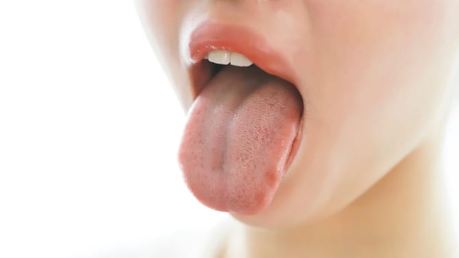 ನಿಮ್ಮ ನಾಲಿಗೆ ಬಣ್ಣದಿಂದ ನಿಮಗಿರುವ ರೋಗವನ್ನು ಪತ್ತೆ ಮಾಡಬಹುದು!