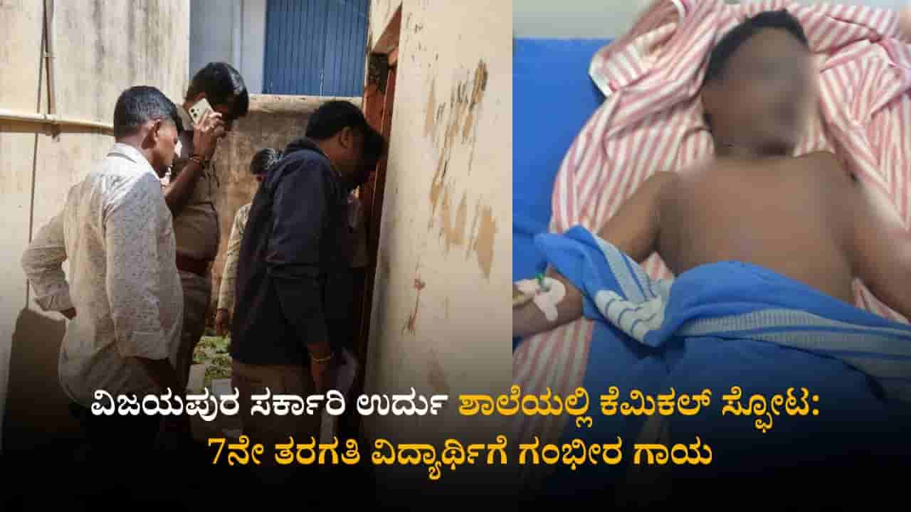ವಿಜಯಪುರ ಸರ್ಕಾರಿ ಉರ್ದು ಶಾಲೆಯಲ್ಲಿ ಕೆಮಿಕಲ್ ಸ್ಫೋಟ: 7ನೇ ತರಗತಿ ವಿದ್ಯಾರ್ಥಿಗೆ ಗಂಭೀರ ಗಾಯ