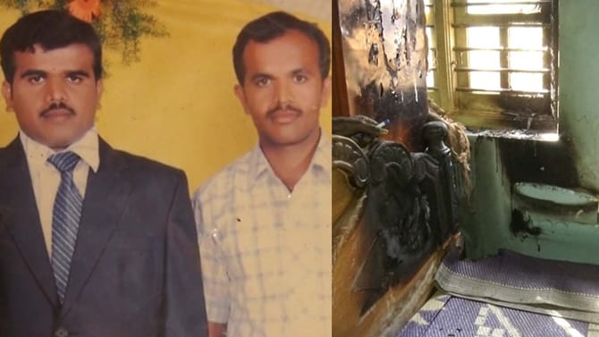 ಅಣ್ಣನ ಮನೆಗೆ ಬೆಂಕಿಯಿಟ್ಟ ತಮ್ಮ; ತಾನೂ ಸುಟ್ಟುಕೊಂಡು ಆಸ್ಪತ್ರೆ ಸೇರಿದ