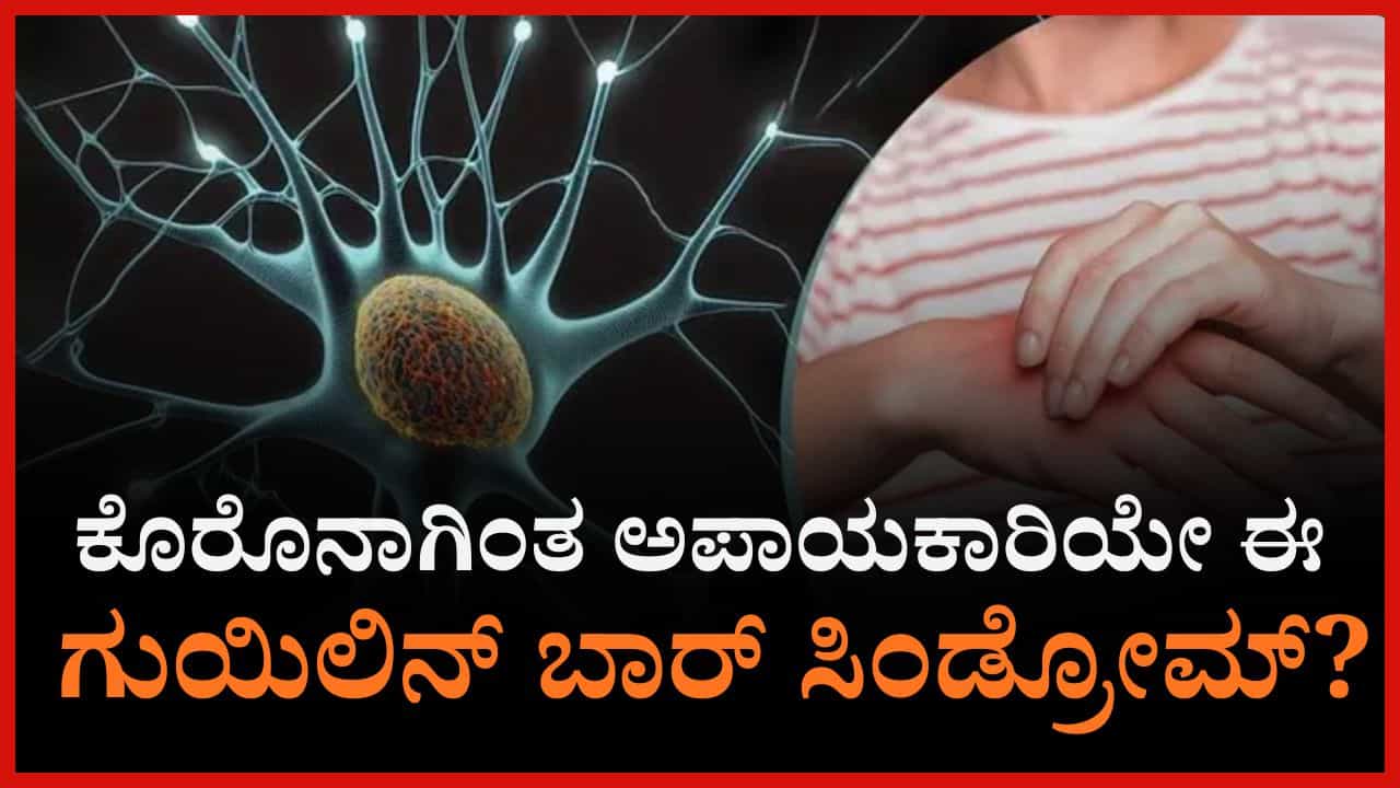 ಕೋವಿಡ್​ಗಿಂತ ಅಪಾಯಕಾರಿಯೇ ಈ ಗುಯಿಲಿನ್‌ ಬಾರ್‌ ಸಿಂಡ್ರೋಮ್‌? ಲಕ್ಷಣಗಳು ಹೇಗಿರುತ್ತೆ, ತಡೆಗಟ್ಟುವುದು ಹೇಗೆ?