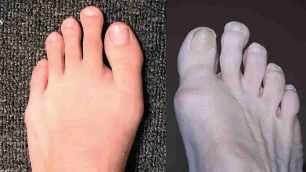 Toe Length Astrology: ಕಾಲಿನ ಹೆಬ್ಬೆರಳಿಗಿಂತ ಪಕ್ಕದ ಬೆರಳು ಉದ್ದ ಇದ್ರೆ ಏನರ್ಥ ಗೊತ್ತಾ?