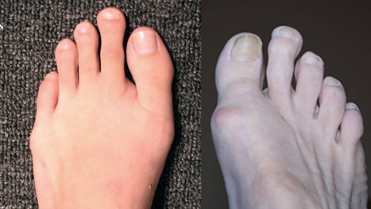 Toe Length Astrology: ಕಾಲಿನ ಹೆಬ್ಬೆರಳಿಗಿಂತ ಪಕ್ಕದ ಬೆರಳು ಉದ್ದ ಇದ್ರೆ ಏನರ್ಥ ಗೊತ್ತಾ? Toe Length Astrology: ಕಾಲಿನ ಹೆಬ್ಬೆರಳಿಗಿಂತ ಪಕ್ಕದ ಬೆರಳು ಉದ್ದ ಇದ್ರೆ ಏನರ್ಥ ಗೊತ್ತಾ?