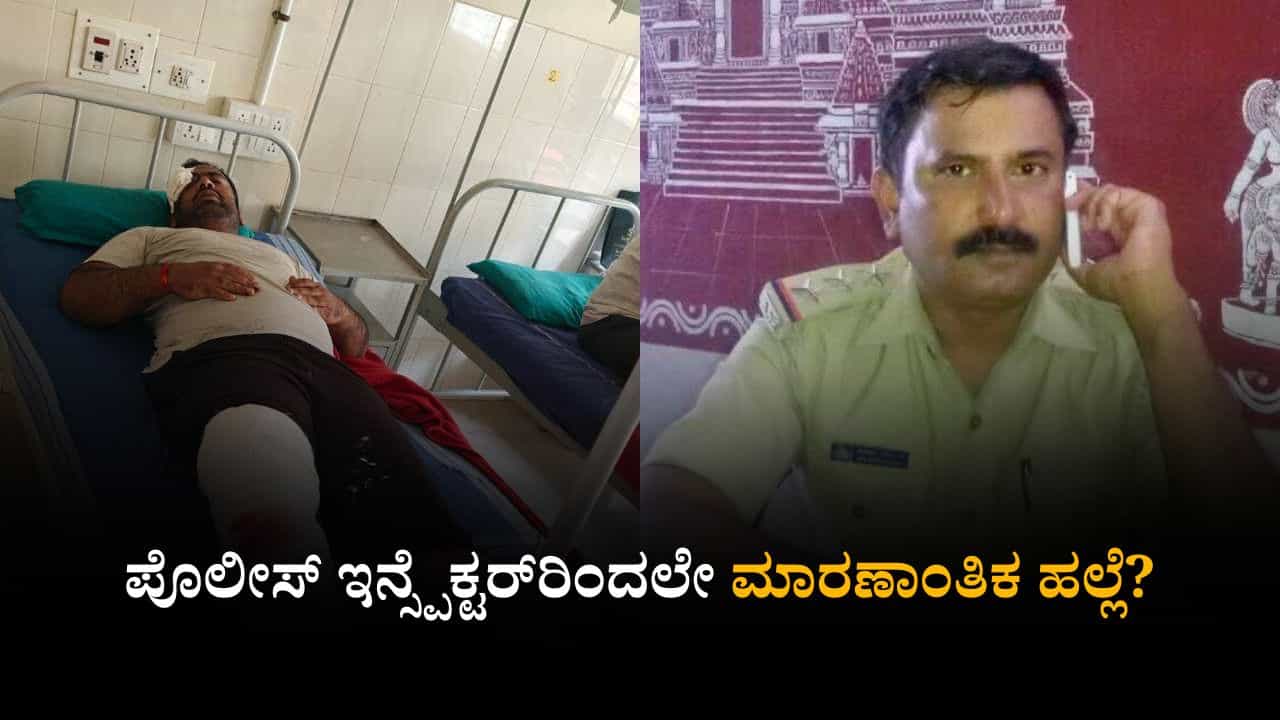 ಹಣ ಕೊಡಲಿಲ್ಲವೆಂದು ಎರಡೂ ಕಾಲು ಮುರಿದ್ರು; ಪೊಲೀಸ್ ಇನ್ಸ್ಪೆಕ್ಟರ್ರಿಂದಲೇ ಮಾರಣಾಂತಿಕ ಹಲ್ಲೆ? ಹಣ ಕೊಡಲಿಲ್ಲವೆಂದು ಎರಡೂ ಕಾಲು ಮುರಿದ್ರು; ಪೊಲೀಸ್ ಇನ್ಸ್ಪೆಕ್ಟರ್ರಿಂದಲೇ ಮಾರಣಾಂತಿಕ ಹಲ್ಲೆ?