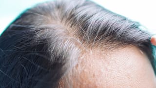 ಕೂದಲು ತುಂಬಾ ಉದುರುತ್ತಿದ್ದರೆ ಶಾಂಪೂ, ಸೀರಮ್‌ ಬದಲಿಸುವ ಬದಲು ಈ ಒಂದು ಕೊರತೆಯನ್ನು ಸರಿದೂಗಿಸಿಕೊಳ್ಳಿ