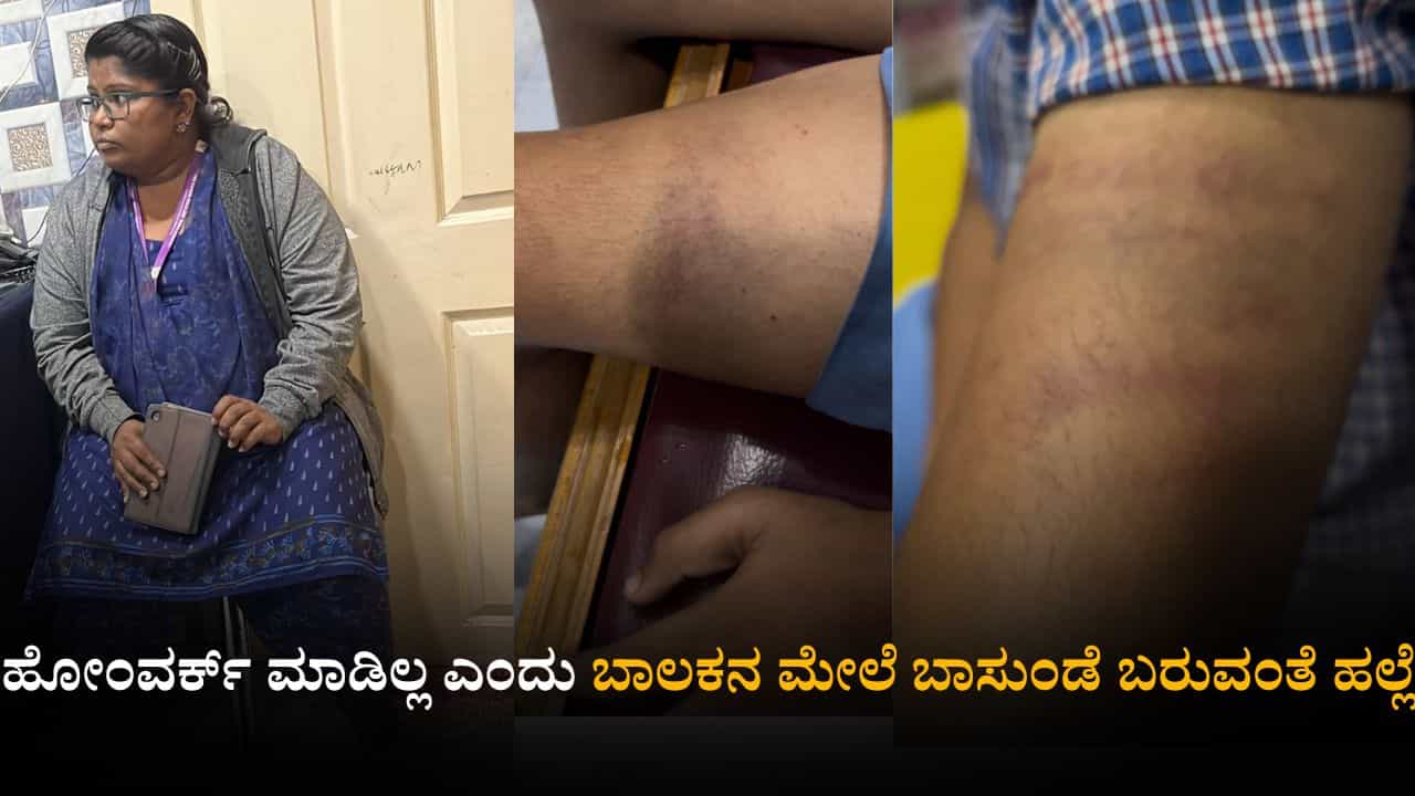 ಹೋಂವರ್ಕ್ ಮಾಡಿಲ್ಲ ಎಂದು ಬಾಲಕನ ಮೇಲೆ ಹಲ್ಲೆ! ‘ಪೋಷಕರಿಗೆ ಹೇಳಿದ್ರೆ ಕುತ್ತಿಗೆ ಹಿಸುಕುತ್ತೇನೆ’ ಎಂದ ಶಿಕ್ಷಕಿ ಹೋಂವರ್ಕ್ ಮಾಡಿಲ್ಲ ಎಂದು ಬಾಲಕನ ಮೇಲೆ ಹಲ್ಲೆ! ‘ಪೋಷಕರಿಗೆ ಹೇಳಿದ್ರೆ ಕುತ್ತಿಗೆ ಹಿಸುಕುತ್ತೇನೆ’ ಎಂದ ಶಿಕ್ಷಕಿ