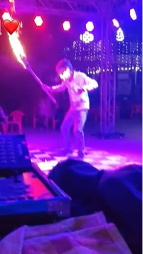 ಬೆಂಕಿಯೊಂದಿಗೆ ಸ್ಟಂಟ್​ ಮಾಡಲು ಹೋಗಿ ಮುಖ ಸುಟ್ಟುಕೊಂಡ ಯುವಕ