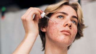 World Pulses Day 2026:  ದ್ವಿದಳ ಧಾನ್ಯಗಳ ಸೇವನೆ ನಮ್ಮ ಆರೋಗ್ಯ ವೃದ್ಧಿಗೆ ಸಹಕಾರಿ