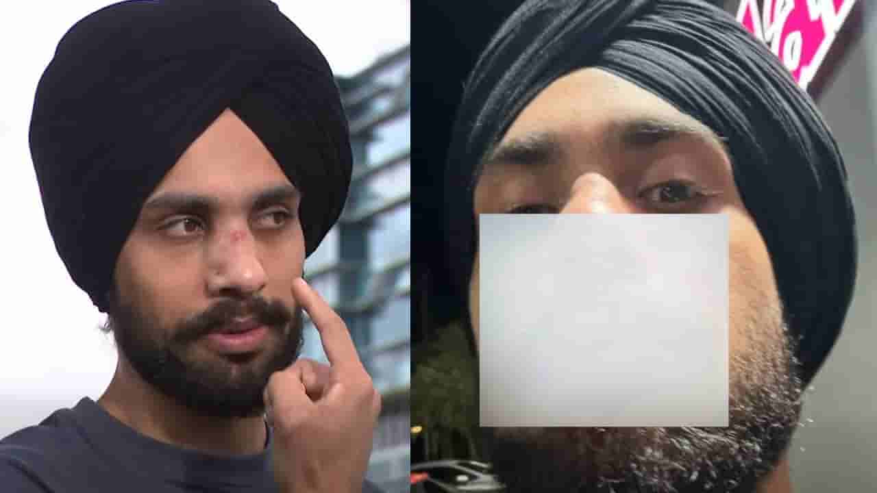 ನೀನು ಭಾರತದ ನಾಯಿ: ಆಸ್ಟ್ರೇಲಿಯಾದಲ್ಲಿ ಜನಾಂಗೀಯವಾಗಿ ನಿಂದಿಸಿ, ಭಾರತ ಮೂಲದ ವ್ಯಕ್ತಿ ಮೇಲೆ ಹಲ್ಲೆ