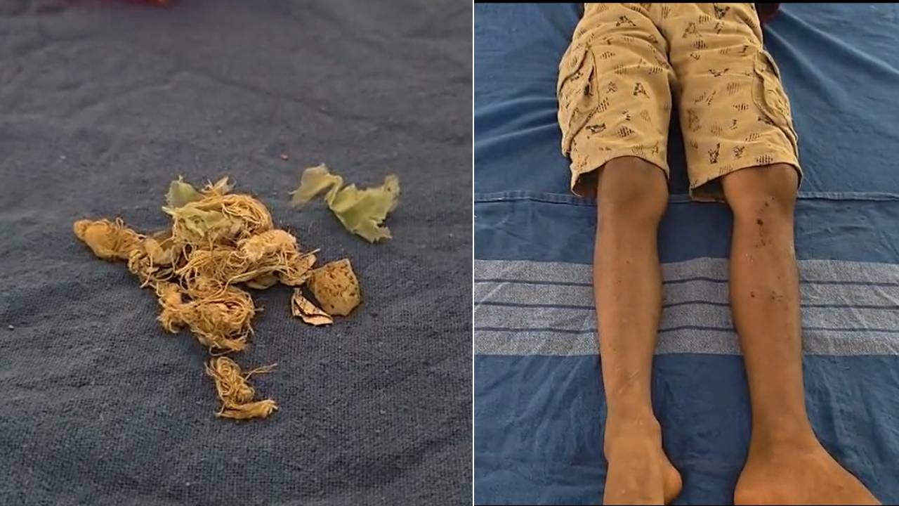 ಮಂಗಳೂರಿನಲ್ಲಿ ಘೋರ ದುರಂತ: ಬಾಲ್ ಎಂದು ಬಾಂಬ್ನಿಂದ ಬೌಲಿಂಗ್: ಬ್ಯಾಟ್ನಿಂದ ಹೊಡೆದಾಗ ಬ್ಲಾಸ್ಟ್ ಮಂಗಳೂರಿನಲ್ಲಿ ಘೋರ ದುರಂತ: ಬಾಲ್ ಎಂದು ಬಾಂಬ್ನಿಂದ ಬೌಲಿಂಗ್: ಬ್ಯಾಟ್ನಿಂದ ಹೊಡೆದಾಗ ಬ್ಲಾಸ್ಟ್