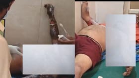 ತನಗೆ ತಾನೇ ಬೆಂಕಿ ಹಚ್ಚಿಕೊಂಡ ಕುಡುಕ! ಮುಂದೇನಾಯ್ತು ನೋಡಿ