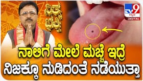 ನಾಲಿಗೆ ಮೇಲೆ ಮಚ್ಚೆ ಇದ್ರೆ ನಿಜಕ್ಕೂ ನುಡಿದಂತೆ ನಡೆಯುತ್ತಾ?