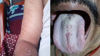 ವಿಚಿತ್ರ ಸಮಸ್ಯೆಗೆ ನಲುಗಿದ ಕುಟುಂಬ: ಇದಕ್ಕಿಂದಂತೆ ರಕ್ತ ಜಿನುಗುವುದು, ಚಿನ್ನ ಮಾಯ, ಬಟ್ಟೆಗಳಿಗೆ ಬೆಂಕಿ