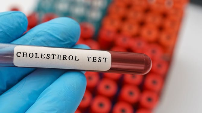 ಕೊಲೆಸ್ಟ್ರಾಲ್ ಹೆಚ್ಚಾದಾಗ ಚರ್ಮದ ಮೇಲೆ ಕಂಡುಬರುವ ಲಕ್ಷಣಗಳು