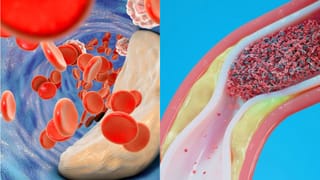 ಮಹಿಳೆಯರಲ್ಲಿ ವಿಟಮಿನ್ ಡಿ ಕೊರತೆಯಾದಾಗ ಈ ರೀತಿಯ ಲಕ್ಷಣಗಳು ಕಂಡುಬರುತ್ತೆ, ಯಾವುದೇ ಕಾರಣಕ್ಕೂ ನಿರ್ಲಕ್ಷಿಸಬೇಡಿ!