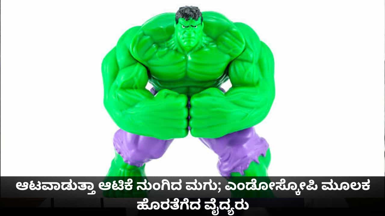 ಆಟವಾಡುತ್ತಾ ಆಟಿಕೆ ನುಂಗಿದ ಮಗು; ಎಂಡೋಸ್ಕೋಪಿ ಮೂಲಕ ಹೊರತೆಗೆದ ವೈದ್ಯರು ಆಟವಾಡುತ್ತಾ ಆಟಿಕೆ ನುಂಗಿದ ಮಗು; ಎಂಡೋಸ್ಕೋಪಿ ಮೂಲಕ ಹೊರತೆಗೆದ ವೈದ್ಯರು