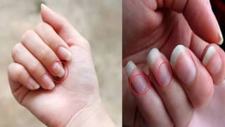 ಮಕ್ಕಳು ಸಿರಪ್ ತೆಗೆದುಕೊಂಡ ತಕ್ಷಣ ವಾಂತಿ ಮಾಡಿದ್ರೆ ಏನು ಮಾಡಬೇಕು? ಇಲ್ಲಿದೆ ತಜ್ಞರ ಸಲಹೆ