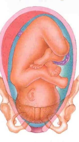 ನಾರ್ಮಲ್ ಡೆಲಿವರಿಗೆ ತಯಾರಿ ಹೇಗೆ? ಡಾಕ್ಟರ್​ ಏನ್​ ಹೇಳ್ತಾರೆ ಕೇಳಿ