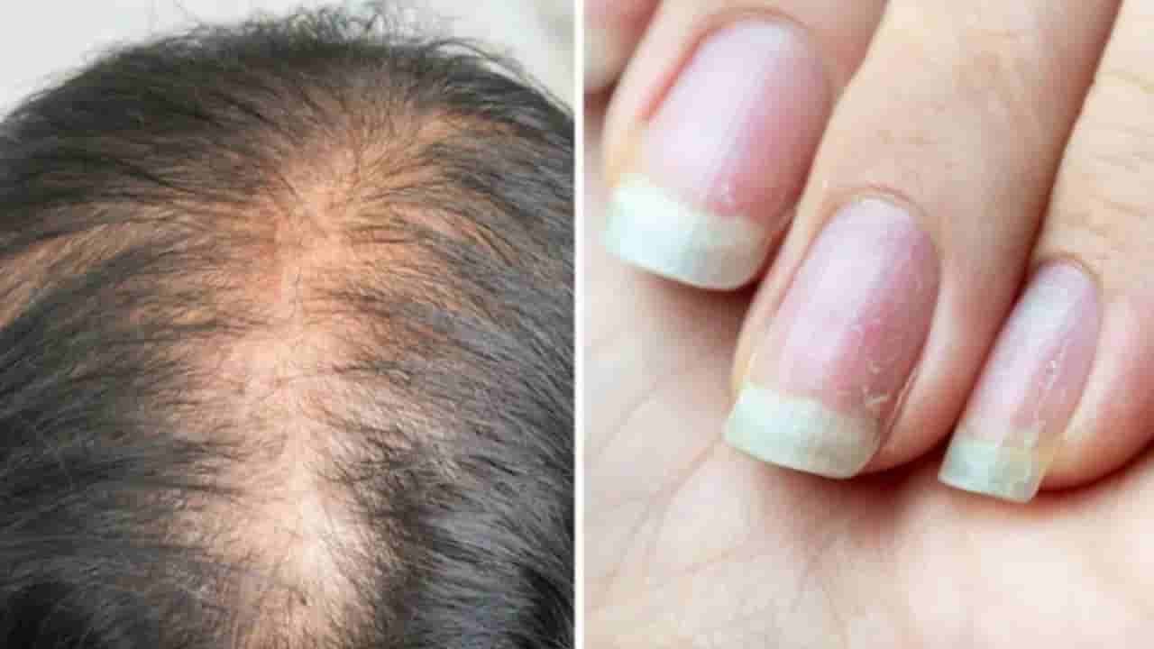 ನಿಮ್ಮ ದೇಹದಲ್ಲಿ ಪ್ರೋಟೀನ್ ಕಡಿಮೆ ಇದೆ ಎಂಬುದನ್ನು ದೇಹ ನೀಡುವ ಈ 6 ಲಕ್ಷಣಗಳ ಮೂಲಕ ತಿಳಿಯಬಹುದು!