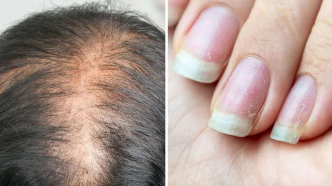 ನಿಮ್ಮ ದೇಹದಲ್ಲಿ ಪ್ರೋಟೀನ್ ಕಡಿಮೆ ಇದೆ ಎಂಬುದನ್ನು ದೇಹ ನೀಡುವ ಈ 6 ಲಕ್ಷಣಗಳ ಮೂಲಕ ತಿಳಿಯಬಹುದು! ನಿಮ್ಮ ದೇಹದಲ್ಲಿ ಪ್ರೋಟೀನ್ ಕಡಿಮೆ ಇದೆ ಎಂಬುದನ್ನು ದೇಹ ನೀಡುವ ಈ 6 ಲಕ್ಷಣಗಳ ಮೂಲಕ ತಿಳಿಯಬಹುದು!