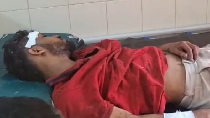 ಲವ್​ ಪ್ರಪೋಸಲ್​​ ಒಪ್ಪದಿದ್ದಕ್ಕೆ ಯುವತಿಗೆ ಇರಿದ ಪಾಗಲ್​​ ಪ್ರೇಮಿ!