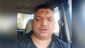 ಕರ್ನಾಟಕ ಮೂಲದ ಉದ್ಯಮಿ ಕೇರಳದಲ್ಲಿ ಬೆಂಕಿ ಹಚ್ಚಿಕೊಂಡು ಆತ್ಮಹತ್ಯೆ