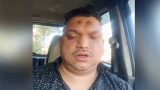 ಕರ್ನಾಟಕ ಮೂಲದ ಉದ್ಯಮಿ ಕೇರಳದಲ್ಲಿ ಬೆಂಕಿ ಹಚ್ಚಿಕೊಂಡು ಆತ್ಮಹತ್ಯೆ: ಪತ್ನಿ, ಮಕ್ಕಳು ಪಾರು