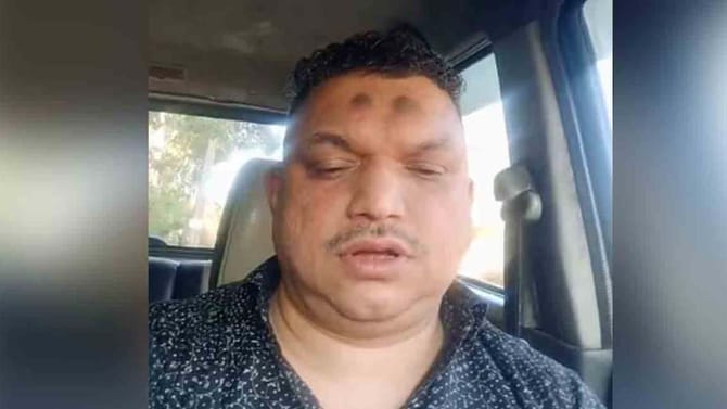 ಕರ್ನಾಟಕ ಮೂಲದ ಉದ್ಯಮಿ ಕೇರಳದಲ್ಲಿ ಬೆಂಕಿ ಹಚ್ಚಿಕೊಂಡು ಆತ್ಮಹತ್ಯೆ