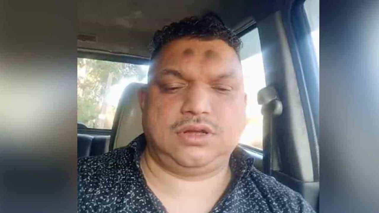 ಕರ್ನಾಟಕ ಮೂಲದ ಉದ್ಯಮಿ ಕೇರಳದಲ್ಲಿ ಬೆಂಕಿ ಹಚ್ಚಿಕೊಂಡು ಆತ್ಮಹತ್ಯೆ: ಪತ್ನಿ, ಮಕ್ಕಳು ಪಾರು