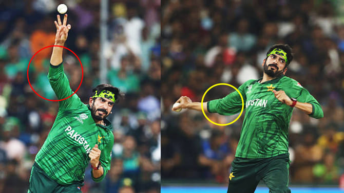 ನನ್ನ ಕೈಯಲ್ಲಿ ಎರಡು ಮೊಣಕೈಗಳಿವೆ, ಅದಕ್ಕೆ ಹಿಂಗೆ ಬೌಲಿಂಗ್ ಮಾಡ್ತೀನಿ!