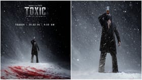 ಟಾಕ್ಸಿಕ್ ಟ್ರೇಲರ್ ನಿರೀಕ್ಷೆಯಲ್ಲಿದ್ದವರಿಗೆ ಬಿಗ್ ಸರ್​​ಪ್ರೈಸ್ ಕೊಟ್ಟ ಯಶ್