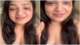 ಬಿಗ್ ಬಾಸ್ ಖ್ಯಾತಿಯ ಅಶ್ವಿನಿ ಮುಖಕ್ಕೆ ಗಾಯ; ಆಗಿದ್ದು ಹೇಗೆ?