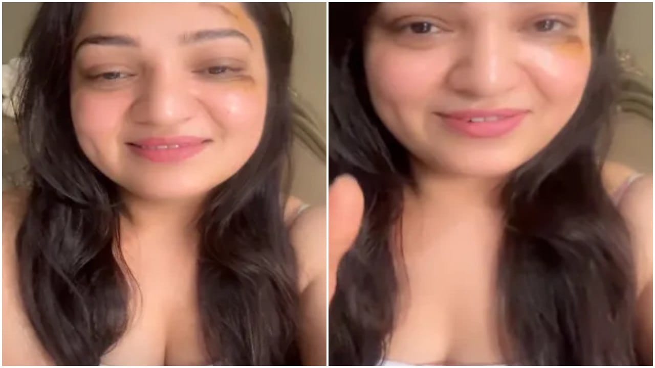 ಬಿಗ್ ಬಾಸ್ ಖ್ಯಾತಿಯ ಅಶ್ವಿನಿ ಮುಖಕ್ಕೆ ಗಾಯ; ಆಗಿದ್ದು ಹೇಗೆ? ಬಿಗ್ ಬಾಸ್ ಖ್ಯಾತಿಯ ಅಶ್ವಿನಿ ಮುಖಕ್ಕೆ ಗಾಯ; ಆಗಿದ್ದು ಹೇಗೆ?