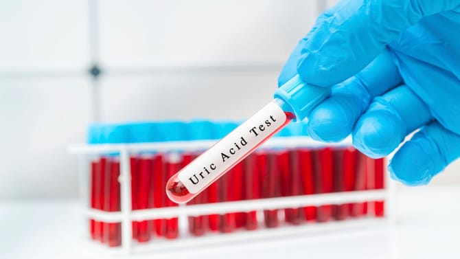 ಮೂತ್ರದಲ್ಲಿ ರಕ್ತ ಕಾಣಿಸಿಕೊಳ್ಳುವುದು ಕಿಡ್ನಿ ಕ್ಯಾನ್ಸರ್ ಲಕ್ಷಣವೇ?