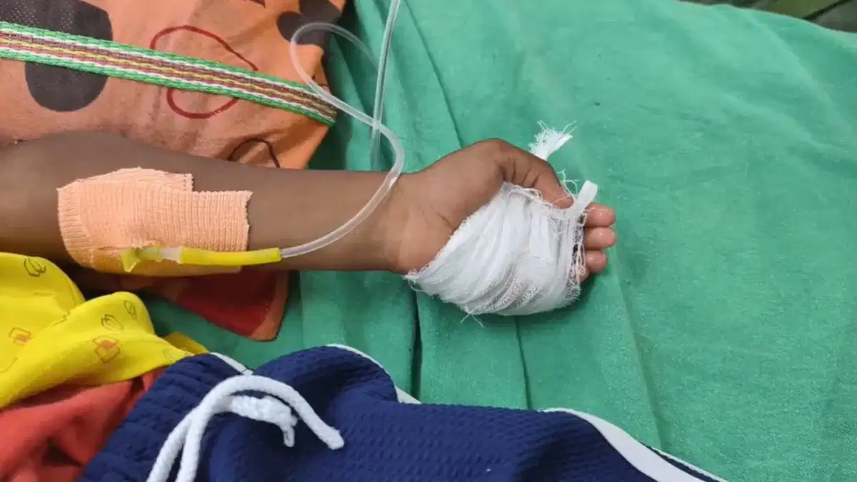 ತೊಂದರೆ ಇದ್ದಿದ್ದು ಬಲಗೈಯಲ್ಲಿ, ಬಾಲಕನ ಎಡಗೈಗೆ ಶಸ್ತ್ರ ಚಿಕಿತ್ಸೆ ಮಾಡಿ ಬೆರಳು ಕತ್ತರಿಸಿದ ವೈದ್ಯರು