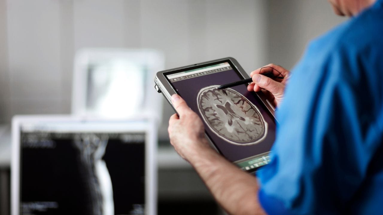 ದೇಹದಲ್ಲಿ ಈ ಲಕ್ಷಣಗಳು ಕಂಡುಬಂದರೆ ನಿರ್ಲಕ್ಷ್ಯ: ಇರಬಹುದು ಬ್ರೈನ್ ಸ್ಟ್ರೋಕ್ ಮುನ್ಸೂಚನೆ!