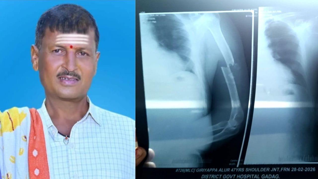 ಮದುವೆ ವಿಚಾರಕ್ಕೆ ನಡೆದ ಗಲಾಟೆ ಕೊಲೆಯಲ್ಲಿ ಅಂತ್ಯ: ಸಹೋದರರಿಂದಲೇ ಹಲ್ಲೆಗೊಳಗಾದ ವ್ಯಕ್ತಿ ಸಾವು