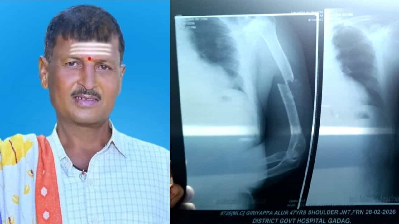 ಮದುವೆ ವಿಚಾರಕ್ಕೆ ನಡೆದ ಗಲಾಟೆ ಕೊಲೆಯಲ್ಲಿ ಅಂತ್ಯ: ಸಹೋದರರಿಂದಲೇ ಹಲ್ಲೆಗೊಳಗಾಗಿದ್ದ ವ್ಯಕ್ತಿ ಸಾವು