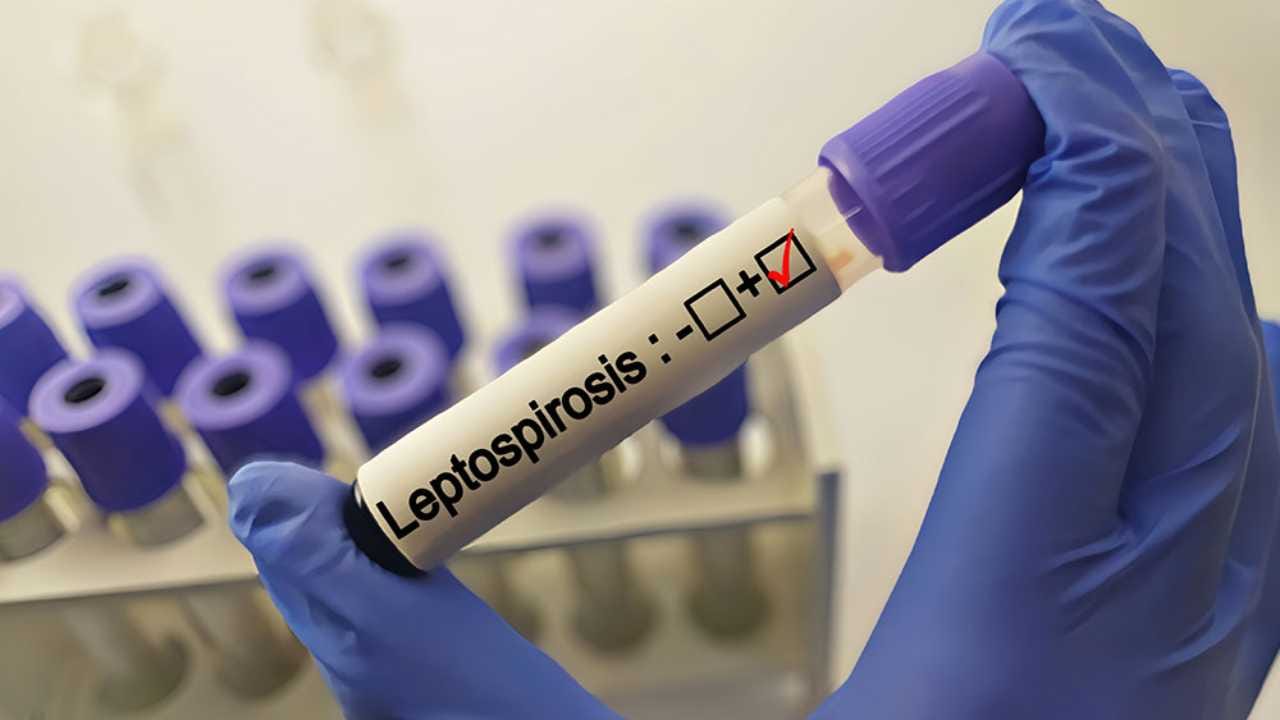 ರಾಜ್ಯದಲ್ಲಿ ಹೆಚ್ಚುತ್ತಿದೆ ಡೆಂಗ್ಯೂ ಮಾದರಿಯ ರೋಗದ ಸೋಂಕು! ಬಚಾವಾಗೋದು ಹೇಗೆ?