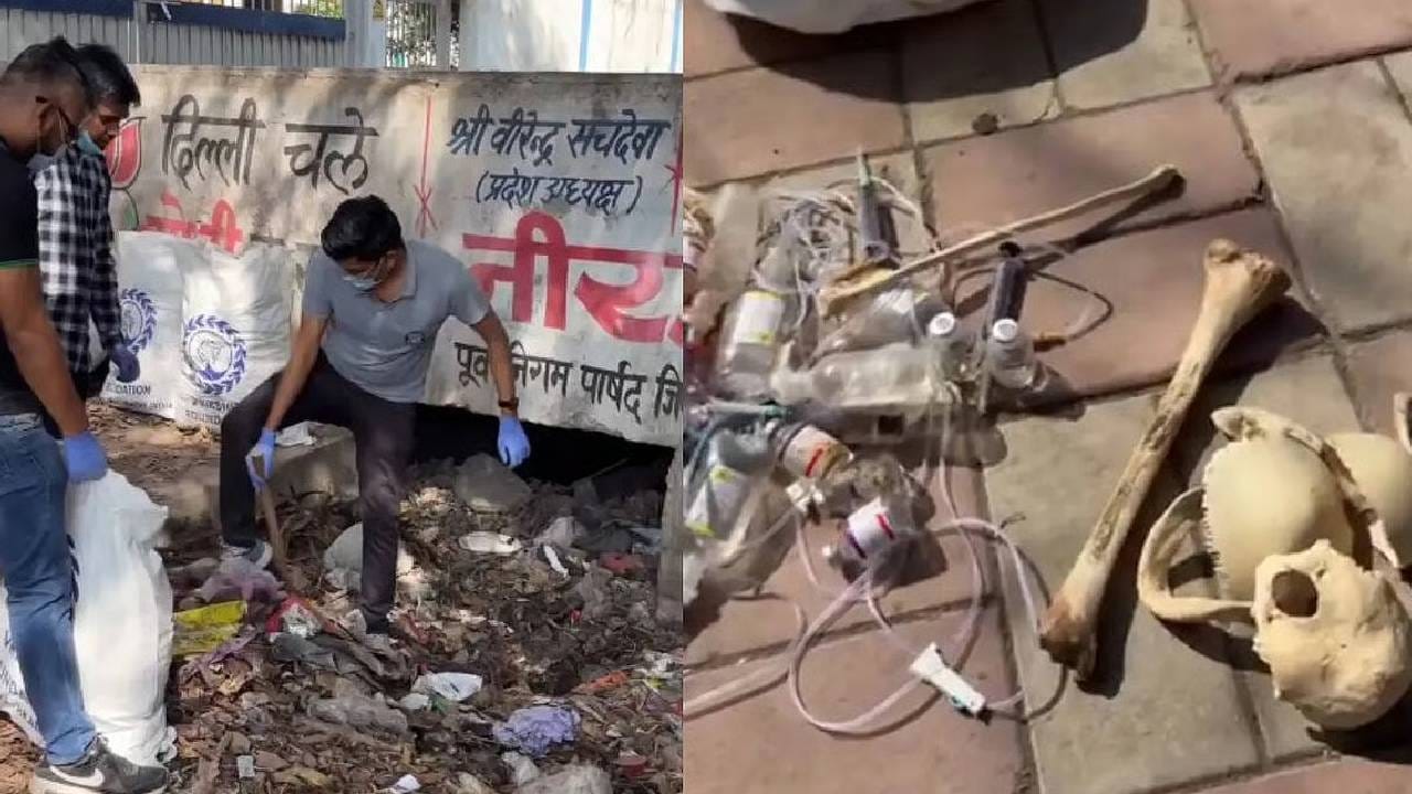 Video: ದೆಹಲಿ ಬೀದಿಯ ಕಸದ ರಾಶಿಯಲ್ಲಿ ಅಸ್ಥಿಪಂಜರ ಪತ್ತೆ Video: ದೆಹಲಿ ಬೀದಿಯ ಕಸದ ರಾಶಿಯಲ್ಲಿ ಅಸ್ಥಿಪಂಜರ ಪತ್ತೆ