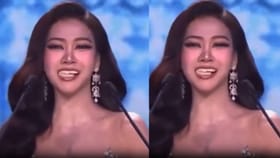 ಸೌಂದರ್ಯ ಸ್ಪರ್ಧೆಯ ವೇದಿಕೆಯಲ್ಲೇ ಉದುರಿಬಿತ್ತು ಸುಂದರಿಯ ಹಲ್ಲು