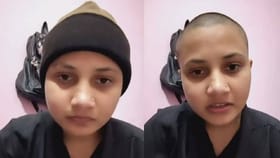 ಮದುವೆ ಒತ್ತಡದಿಂದ ತಪ್ಪಿಸಿಕೊಳ್ಳಲು ತಲೆ ಬೋಳಿಸಿಕೊಂಡ ಯುವತಿ