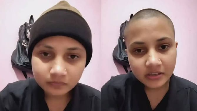 ಮದುವೆ ಒತ್ತಡದಿಂದ ತಪ್ಪಿಸಿಕೊಳ್ಳಲು ತಲೆ ಬೋಳಿಸಿಕೊಂಡ ಯುವತಿ