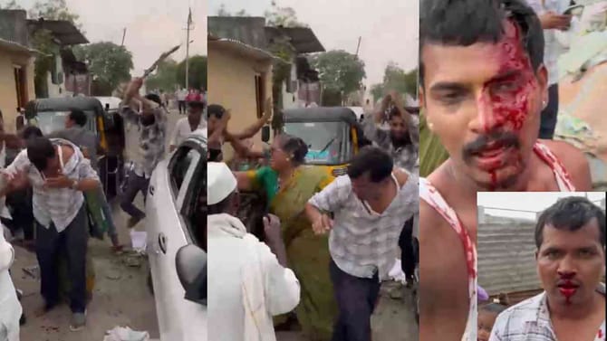 ಆಟೋ ಸೈಡ್‌ಗೆ ಹಾಕಿ ಎಂದಿದ್ದಕ್ಕೆ ಜಮೀರ್ ಸಹೋದರರಿಂದ ಮಾರಣಾಂತಿಕ ಹಲ್ಲೆ!