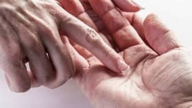 ನಿಮ್ಮ ಅಂಗೈಯಲ್ಲಿದೆಯೇ ಸರ್ಕಾರಿ ಉದ್ಯೋಗದ ಯೋಗ?