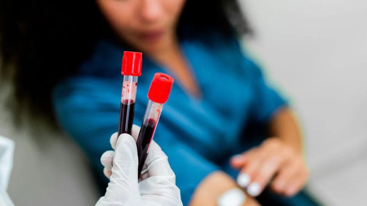 ಬ್ಲಡ್ ಟೆಸ್ಟ್ಗೆ ಮನೆಯಲ್ಲಿಯೇ ಸ್ಯಾಂಪಲ್ ಕೊಡುವುದು ಉತ್ತಮವಾ ಅಥವಾ ಲ್ಯಾಬ್ಗೆ ಹೋಗುವುದೇ? ಇಲ್ಲಿದೆ ತಜ್ಞರ ಸಲಹೆ