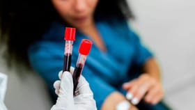 ಬ್ಲಡ್ ಟೆಸ್ಟ್‌ಗೆ ಮನೆ ಅಥವಾ ಲ್ಯಾಬ್‌ ಎಲ್ಲಿ ಸ್ಯಾಂಪಲ್ ಕೊಡುವುದು ಉತ್ತಮ?